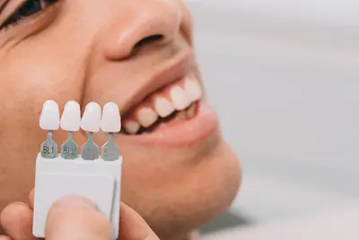 Când este necesară coroana dentară: tipuri si utilizări